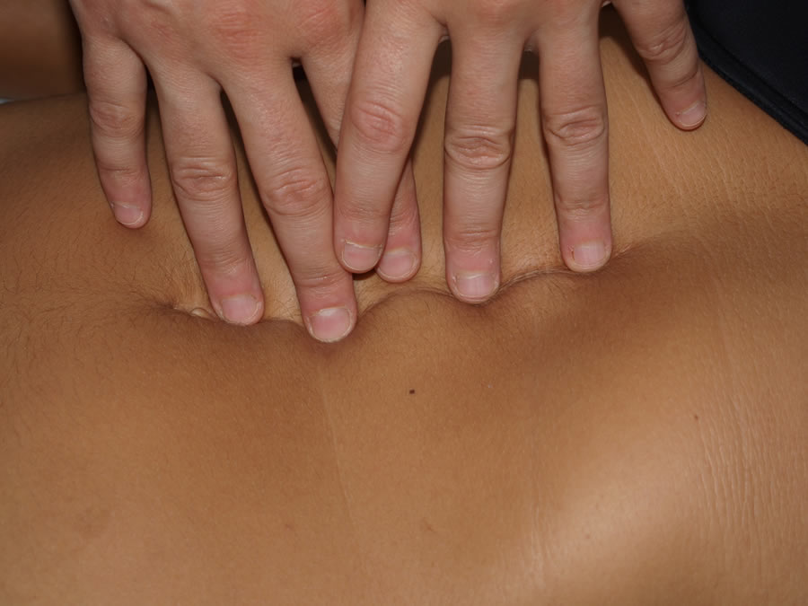 Tecnica sulle cicatrici